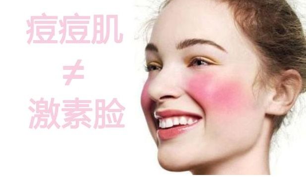 “激素脸”和“痘痘肌”都分不清